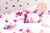 Mélange perles rocaille camaïeu rose violet , perles pour création bijoux x 10gr (G9510)